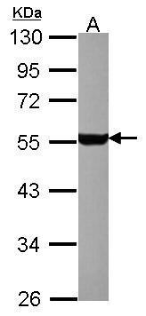 5HT1A receptor antibody [N3C1], Internal detects 5HT1A receptor protein by western blot analysis.A. 20 μg D-hippocampus C9 lysate/extract10% SDS-PAGE5HT1A receptor antibody [N3C1], Internal (GRP569) dilution: 1:1000 The HRP-conjugated anti-rabbit IgG a