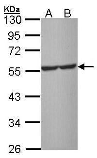 Sample (30 μg of whole cell lysate) A: Molt-4 (GRP569) B: Raji 10% SDS PAGE  diluted at 1:1000 The HRP-conjugated anti-rabbit IgG antibody  was used to detect the primary antibody.