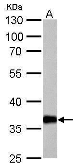 AKR1C1 antibody detects AKR1C1 protein by western blot analysis.A. 50 μg mouse liver lysate/extract10% SDS-PAGEAKR1C1 antibody (GRP491) dilution: 1:1000 The HRP-conjugated anti-rabbit IgG antibody  was used to detect the primary antibody.