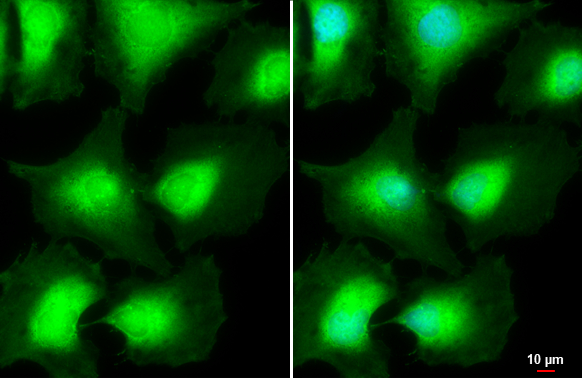AKT antibody [N3C2], Internal detects AKT protein at cytoplasm by immunofluorescent analysis.Sample: HeLa cells were fixed in 4% paraformaldehyde at RT for 15 min.Green: AKT stained by AKT antibody [N3C2], Internal (GRP513) diluted at 1:500.Blue: Hoechst 