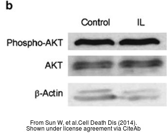 The WB analysis of AKT antibody [N3C2], Internal was published by Sun W and colleagues in the journal Cell Death Dis in 2014 .