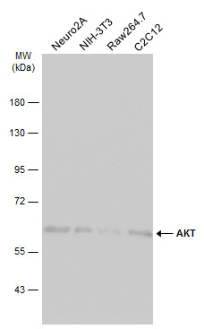 Various whole cell extracts (30 μg) were separated by 7.5% SDS-PAGE, and the membrane was blotted with AKT antibody [N3C2], Internal (GRP513) diluted at 1:1000. The HRP-conjugated anti-rabbit IgG antibody  was used to detect the primary antibody, and t