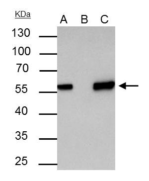 Akt1 antibody immunoprecipitates Akt1 protein in IP experiments.IP samples: 30 ?g whole cell extract of Akt1-transfected 293T cells.A. 30 ?g whole cell extract of Akt1-protein expressing 293T cellB. Control with 3 ?g of preimmune Rabbit IgGC. Immunoprecip