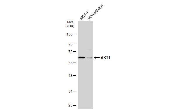 Various whole cell extracts (30 μg) were separated by 10% SDS-PAGE, and the membrane was blotted with AKT1 antibody (GRP499) diluted at 1:1000. The HRP-conjugated anti-rabbit IgG antibody  was used to detect the primary antibody.