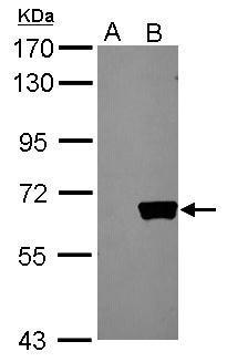 Sample (20 ug of whole cell lysate)  A: HeLa cell lysate   B: HeLa cell transfect with AKT   7.5% SDS PAGE  GRP499 diluted at 1:10000 