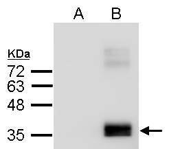 Sample (2.5 μg of whole cell lysate)  A: Conditional medium from human primary preadipocyte  B: Conditional medium from differentiated human primary preadipocyte  12% SDS PAGE  GRP546 diluted at 1:2000 The HRP-conjugated anti-rabbit IgG antibody  was u