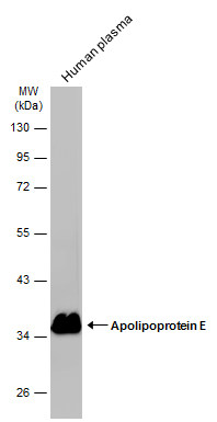 Human plasma (30 μg) was separated by 10% SDS-PAGE, and the membrane was blotted with Apolipoprotein E antibody [C2C3], C-term (GRP546) diluted at 1:10000. The HRP-conjugated anti-rabbit IgG antibody  was used to detect the primary antibody.