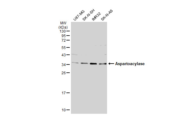 Various whole cell extracts (30 μg) were separated by 10% SDS-PAGE, and the membrane was blotted with Aspartoacylase antibody [N1C3-2] (GRP590) diluted at 1:1000. The HRP-conjugated anti-rabbit IgG antibody  was used to detect the primary antibody.