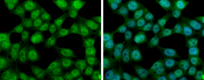 Ataxin 3 antibody detects Ataxin 3 protein at cytoplasm and nucleus by immunofluorescent analysis.Sample: 293T cells were fixed in 4% paraformaldehyde at RT for 15 min.Green: Ataxin 3 stained by Ataxin 3 antibody (GRP597) diluted at 1:500.Blue: Hoechst 33