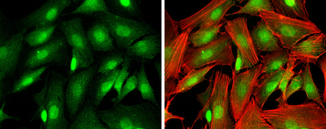 Ataxin 3 antibody detects Ataxin 3 protein at cytoplasm and nucleus by immunofluorescent analysis.Sample: SK-N-SH cells were fixed in 4% paraformaldehyde at RT for 15 min.Green: Ataxin 3 protein stained by Ataxin 3 antibody (GRP597) diluted at 1:250.Blue: