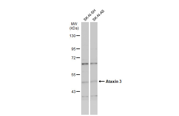 Various whole cell extracts (30 μg) were separated by 7.5% SDS-PAGE, and the membrane was blotted with Ataxin 3 antibody (GRP597) diluted at 1:1000. The HRP-conjugated anti-rabbit IgG antibody  was used to detect the primary antibody.