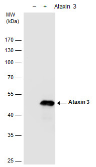 Ataxin 3 antibody detects Ataxin 3 protein by western blot analysis.293T mock transfected (-) or transfected with a construct expressing human Ataxin 3 (+).10% SDS-PAGEAtaxin 3 antibody (GRP597) dilution: 1:5000 The HRP-conjugated anti-rabbit IgG antibody
