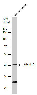 Ataxin 3 antibody detects Ataxin 3 protein by western blot analysis. Mouse tissue extracts (50 μg) was separated by 10% SDS-PAGE, and blotted with Ataxin 3 antibody (GRP597) diluted by 1:500. The HRP-conjugated anti-rabbit IgG antibody  was used to det