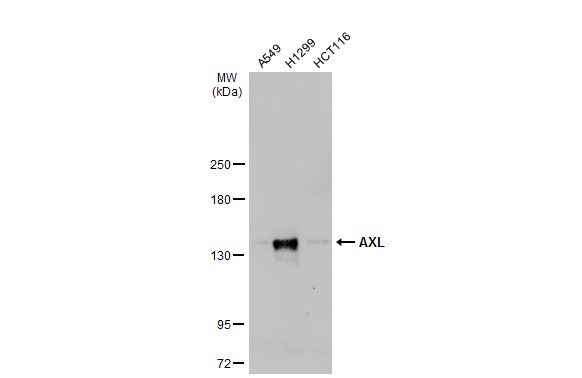 Various whole cell extracts (30 μg) were separated by 5% SDS-PAGE, and the membrane was blotted with AXL antibody (GRP526) diluted at 1:1000. The HRP-conjugated anti-rabbit IgG antibody  was used to detect the primary antibody.