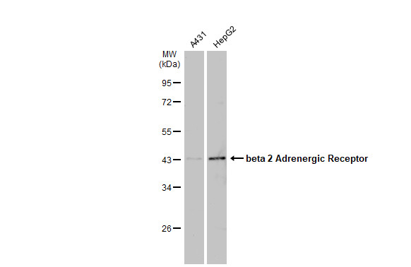 Various whole cell extracts (30 ?g) were separated by 10% SDS-PAGE, and the membrane was blotted with beta 2 Adrenergic Receptor antibody [C2C3], C-term (GRP544) diluted at 1:500. The HRP-conjugated anti-rabbit IgG antibody  was used to detect the primary