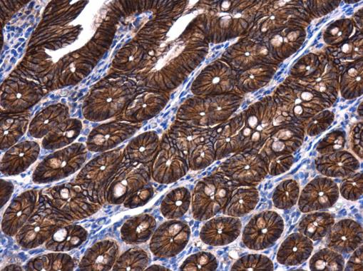 beta Catenin antibody [N1N2-2], N-term detects beta Catenin protein at cell membrane and cytoplasm in mouse intestine by immunohistochemical analysis. Sample: Paraffin-embedded mouse intestine. beta Catenin antibody [N1N2-2], N-term (GRP474) diluted at 1: