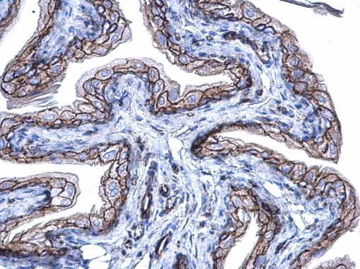 beta Catenin antibody [N1N2-2], N-term detects beta Catenin protein at membrane on mouse colon by immunohistochemical analysis. Sample: Paraffin-embedded mouse colon. beta Catenin antibody [N1N2-2], N-term (GRP474) dilution: 1:500.