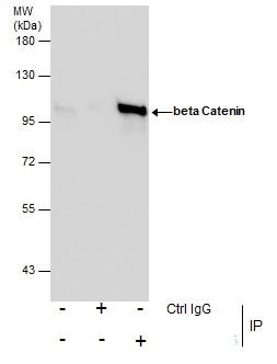 beta Catenin antibody [N1N2-2] detects beta Catenin protein at cell membrane in mouse colon by immunohistochemical analysis. Sample: Paraffin-embedded mouse colon. Green: beta Catenin antibody [N1N2-2] (GRP474) diluted at 1:500.Red: alpha Tubulin antibody