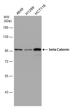 beta Catenin antibody [N1N2-2], N-term detects beta Catenin protein at cell membrane and cytoplasm in human esophagus by immunohistochemical analysis. Sample: Paraffin-embedded human esophagus. beta Catenin antibody [N1N2-2], N-term (GRP474) diluted at 1: