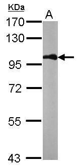 beta Catenin antibody [N1N2-2], N-term detects beta Catenin protein at cell membrane and cytoplasm in rat duodenum by immunohistochemical analysis. Sample: Paraffin-embedded rat duodenum. beta Catenin antibody [N1N2-2], N-term (GRP474) diluted at 1:500.