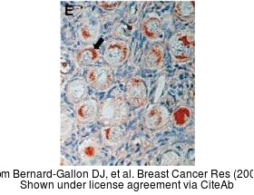 The IHC-P analysis of BRCA1 antibody [17F8] - ChIP grade was published by Bernard-Gallon DJ and colleagues in the journal Breast Cancer Res in 2001.PMID: 11250747