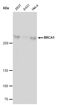 BRCA1 antibody [17F8] - ChIP grade detects BRCA1 protein by western blot analysis. Various whole cell extracts (30 μg) were separated by 5% SDS-PAGE, and blotted with BRCA1 antibody [17F8] - ChIP grade (GRP537) diluted by 1:500. The HRP-conjugated anti
