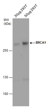 BRCA1 antibody detects BRCA1 protein by western blot analysis. Whole cell extracts (30 and 50 μg) was separated by 5% SDS-PAGE, and the membrane was blotted with BRCA1 antibody (GRP538) at a dilution of 1:500. The HRP-conjugated anti-mouse IgG antibody