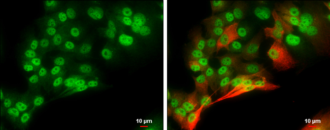 Brn2 antibody detects Brn2 protein at nucleus by immunofluorescent analysis.Sample: SK-N-AS cells were fixed in 4% paraformaldehyde at RT for 15 min.Green: Brn2 protein stained by Brn2 antibody (GRP596) diluted at 1:1000.Red: beta Tubulin 3/ Tuj1, a cytos