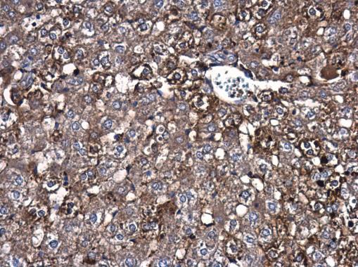 Caspase 3 antibody detects Caspase 3 protein at cytoplasm in rat liver by immunohistochemical analysis. Sample: Paraffin-embedded rat liver. Caspase 3 antibody (GRP498) diluted at 1:500.