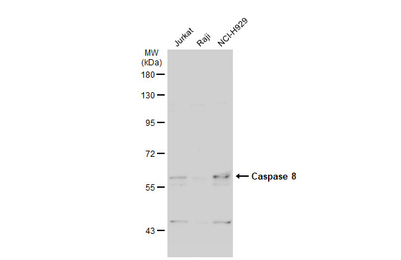 Various whole cell extracts (30 μg) were separated by 7.5% SDS-PAGE, and the membrane was blotted with Caspase 8 antibody (GRP500) diluted at 1:1000. The HRP-conjugated anti-rabbit IgG antibody  was used to detect the primary antibody.