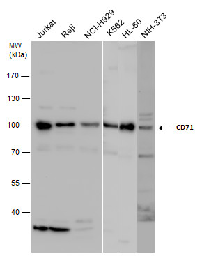 CD71 antibody detects CD71 protein by western blot analysis. Various whole cell extracts (30 μg) were separated by 7.5% SDS-PAGE, and the membrane was blotted with CD71 antibody (GRP479) diluted at a dilution of 1:1000. The HRP-conjugated anti-rabbit I