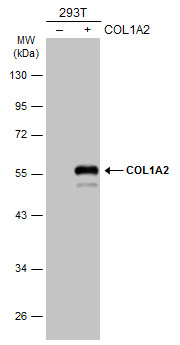 Non-transfected (â€“) and transfected (+) 293T whole cell extracts (30 μg) were separated by 10% SDS-PAGE, and the membrane was blotted with COL1A2 antibody [C2C3], C-term (GRP483) diluted at 1:5000. The HRP-conjugated anti-rabbit IgG antibody  was use