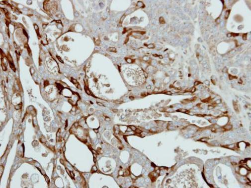 Immunohistochemical analysis of paraffin-embedded NCIN87 xenograft, using Collagen III (GRP501) antibody at 1:500 dilution.