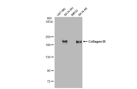 Various whole cell extracts (30 μg) were separated by 5% SDS-PAGE, and the membrane was blotted with Collagen III antibody [C2C3-2], C-term (GRP501) diluted at 1:2000. The HRP-conjugated anti-rabbit IgG antibody  was used to detect the primary antibody