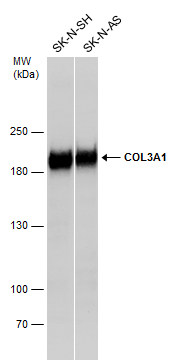 Various whole cell extracts (30 μg) were separated by 5% SDS-PAGE, and the membrane was blotted with Collagen III antibody [C2C3], C-term (GRP484) diluted at 1:5000. The HRP-conjugated anti-rabbit IgG antibody  was used to detect the primary antibody.