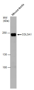 Collagen III antibody [C2C3], C-term detects Collagen III protein by western blot analysis. Mouse tissue extracts (30 μg) was separated by 5% SDS-PAGE, and the membrane was blotted with Collagen III antibody [C2C3], C-term (GRP484) at a dilution of 1:1