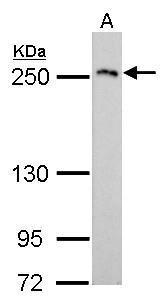 Collagen III antibody [C2C3], C-term detects Collagen III protein by western blot analysis.A. 50 μg rat liver lysate/extract 5% SDS-PAGECOL3A1 antibody [C2C3], C-term (GRP484) dilution: 1:1000 The HRP-conjugated anti-rabbit IgG antibody  was used to de
