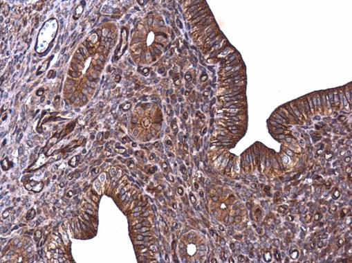 E-Cadherin antibody detects E-Cadherin protein at cell membrane in mouse cervix by immunohistochemical analysis. Sample: Paraffin-embedded mouse cervix. E-Cadherin antibody (GRP459) diluted at 1:500.