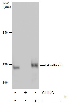 Immunoprecipitation of E-Cadherin protein from MCF-7 whole cell extracts using 5 ?g of E-Cadherin antibody (GRP459).Western blot analysis was performed using E-Cadherin antibody (GRP459).EasyBlot anti-Rabbit IgG  was used as a secondary reagent.
