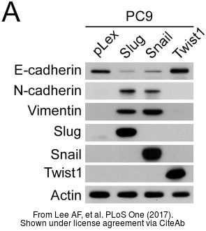 The WB analysis of E-Cadherin antibody was published by Lee AF and colleagues in the journal PLoS One in 2017.PMID: 28683123
