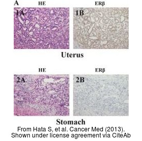 The IHC-P analysis of Estrogen Receptor beta antibody [14C8] was published by Hata S and colleagues in the journal Cancer Med in 2013.PMID: 23930207
