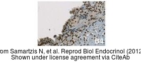 The IHC-P analysis of Estrogen Receptor beta antibody [14C8] was published by Samartzis N and colleagues in the journal Reprod Biol Endocrinol in 2012.PMID: 22520060