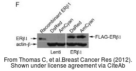 The WB analysis of Estrogen Receptor beta antibody [14C8] was published by Thomas C and colleagues in the journal Breast Cancer Res in 2012 .