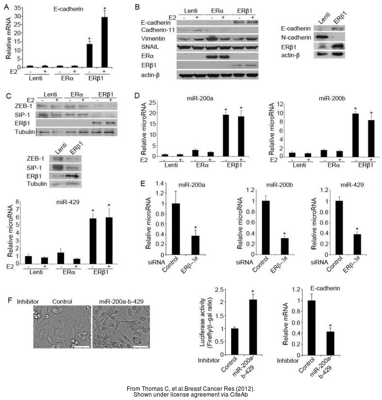 The WB analysis of Estrogen Receptor beta antibody [14C8] was published by Thomas C and colleagues in the journal Breast Cancer Res in 2012 .