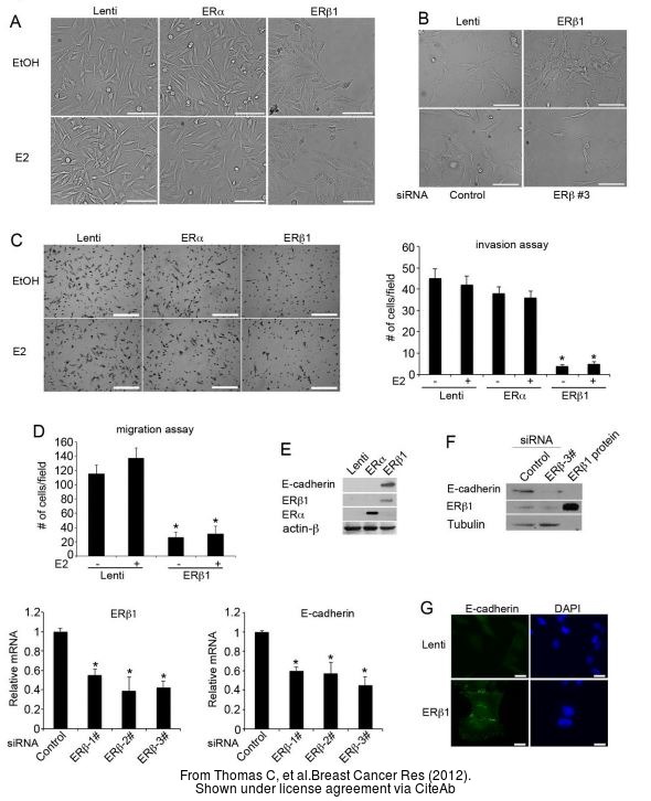 The WB analysis of Estrogen Receptor beta antibody [14C8] was published by Thomas C and colleagues in the journal Breast Cancer Res in 2012 .