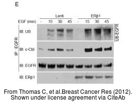 The WB analysis of Estrogen Receptor beta antibody [14C8] was published by Thomas C and colleagues in the journal Breast Cancer Res in 2012 .