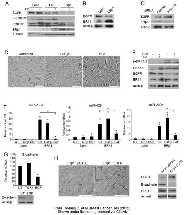 The WB analysis of Estrogen Receptor beta antibody [14C8] was published by Thomas C and colleagues in the journal Breast Cancer Res in 2012 .