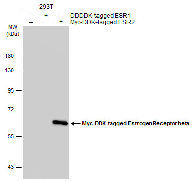 Non-transfected (â€“) and transfected (+) 293T whole cell extracts (30 μg) were separated by 7.5% SDS-PAGE, and the membrane was blotted with Estrogen Receptor beta antibody [14C8] (GRP539) diluted at 1:5000. The HRP-conjugated anti-mouse IgG antibody 