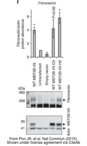 The WB analysis of Fibronectin antibody [N1N2], N-term was published by Pon JR and colleagues in the journal Nat Commun in 2015.PMID: 26245647