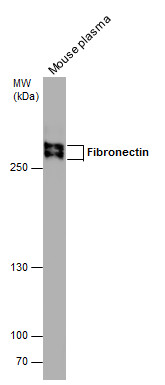 Fibronectin antibody [N1N2] detects Fibronectin protein by western blot analysis. Mouse tissue extracts (50 μg) was separated by 5% SDS-PAGE, and the membrane was blotted with Fibronectin antibody [N1N2] (GRP505) diluted at 1:1000. The HRP-conjugated a